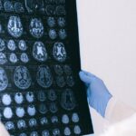 cyclist-alzheimer-research