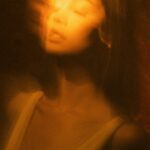 eye-color-change-surgery