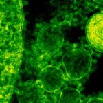 hepatitis-A-outbreak