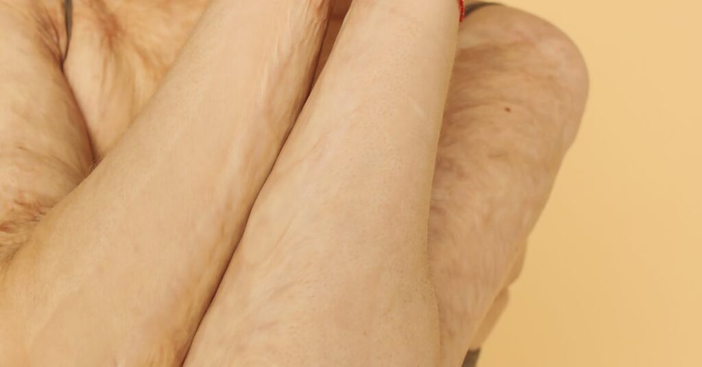Illustration de Un soin de beauté tourne au cauchemar waxing-burn-injury