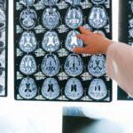 brain-injury-patient