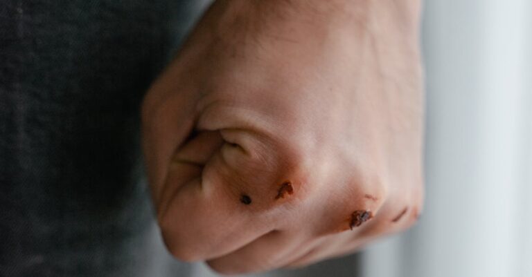 Aleppo-conflict-violence