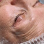 elderly-patient-hospital-bed